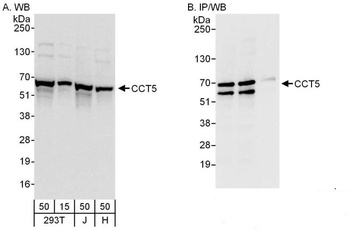Rabbit anti-CCT5 Antibody