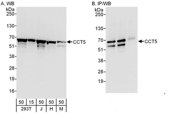 Rabbit anti-CCT5 Antibody