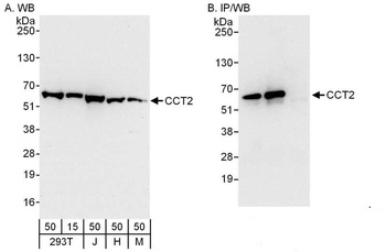 Rabbit anti-CCT2 Antibody