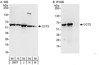 Rabbit anti-CCT2 Antibody