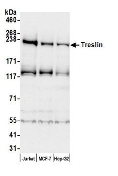 Treslin Antibody