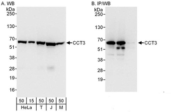 Rabbit anti-CCT3 Antibody