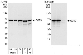 Rabbit anti-CCT3 Antibody