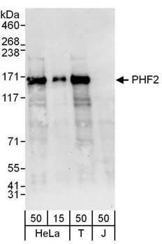 Rabbit anti-PHF2 Antibody