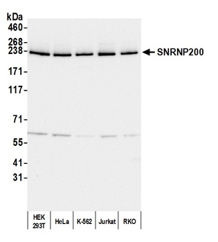 Rabbit anti-SNRNP200 Antibody