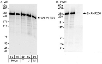 Rabbit anti-SNRNP200 Antibody