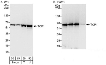 Rabbit anti-TCP1 Antibody