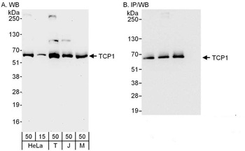Rabbit anti-TCP1 Antibody