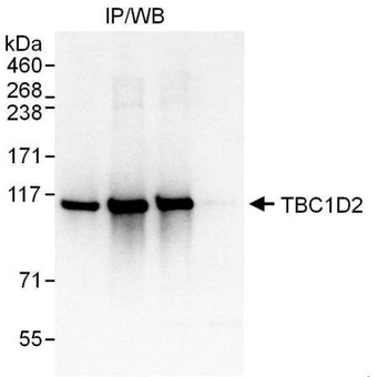Rabbit anti-TBC1D2 Antibody