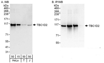TBC1D2 Antibody