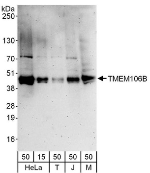 Rabbit anti-TMEM106B Antibody