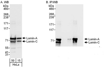 Lamin-A/C Antibody