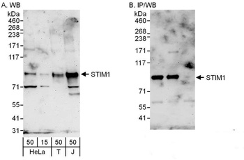 Rabbit anti-STIM1 Antibody