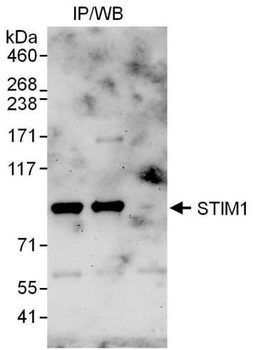 Rabbit anti-STIM1 Antibody