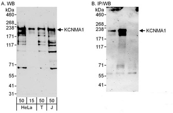 Rabbit anti-KCNMA1 Antibody