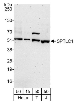 Rabbit anti-SPTLC1 Antibody