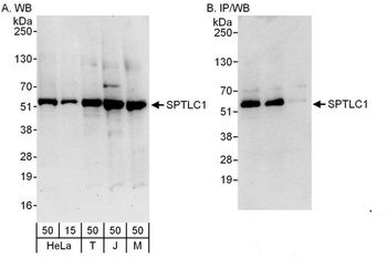 Rabbit anti-SPTLC1 Antibody