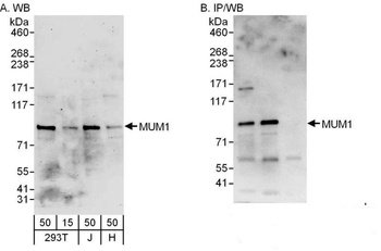 Rabbit anti-MUM1 Antibody