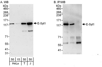Rabbit anti-E-Syt1 Antibody