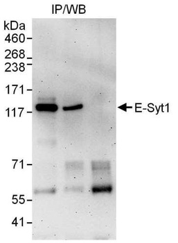 Rabbit anti-E-Syt1 Antibody