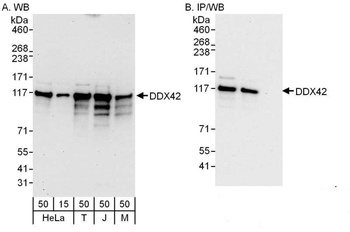 Rabbit anti-DDX42 Antibody