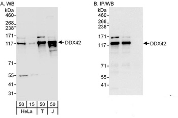 Rabbit anti-DDX42 Antibody