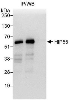 Rabbit anti-HIP55 Antibody