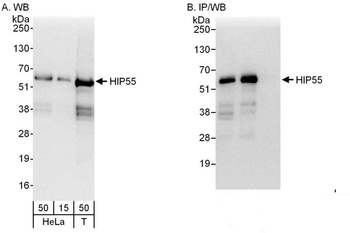 Rabbit anti-HIP55 Antibody