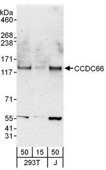 CCDC66 Antibody