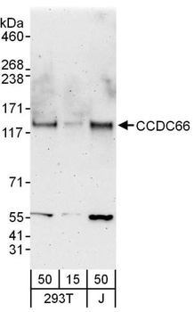 Rabbit anti-CCDC66 Antibody