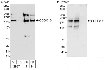 CCDC18 Antibody