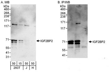Rabbit anti-IGF2BP2 Antibody