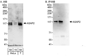 Rabbit anti-ASAP2 Antibody