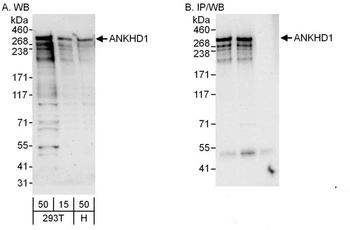 ANKHD1 Antibody