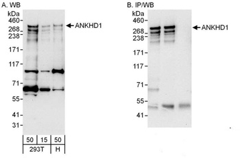 ANKHD1 Antibody