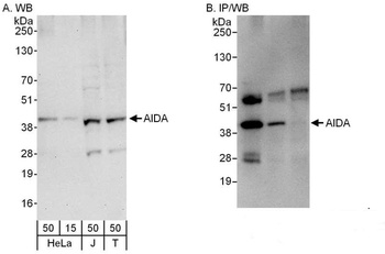 Rabbit anti-AIDA Antibody