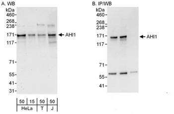 Rabbit anti-AHI1 Antibody