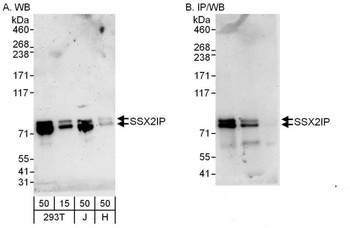 Rabbit anti-SSX2IP Antibody