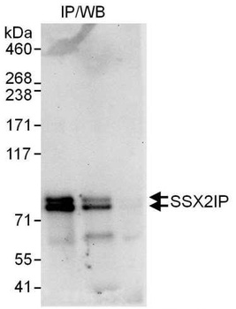 SSX2IP Antibody