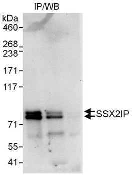 Rabbit anti-SSX2IP Antibody