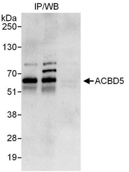 ACBD5 Antibody