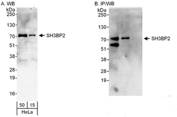 Rabbit anti-SH3BP2 Antibody