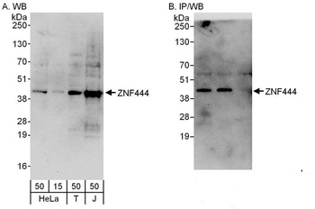 ZNF444 Antibody