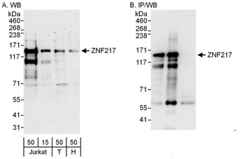 Rabbit anti-ZNF217 Antibody