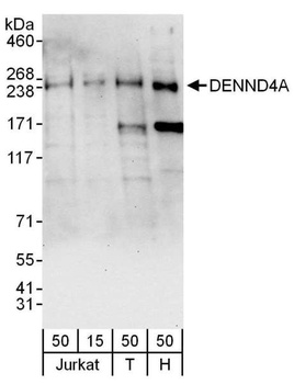 Rabbit anti-DENND4A Antibody