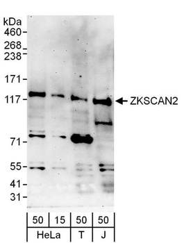 ZKSCAN2 Antibody