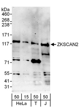 Rabbit anti-ZKSCAN2 Antibody