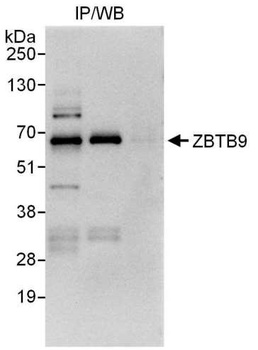 ZBTB9 Antibody