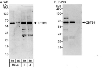 ZBTB9 Antibody
