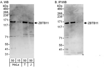 ZBTB11 Antibody